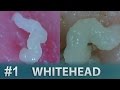 #1 Squeezing Whiteheads Close Up