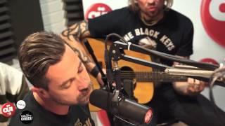 Miniatura de "Les Fatals Picards - Gros Con - Session Acoustique OÜI FM"