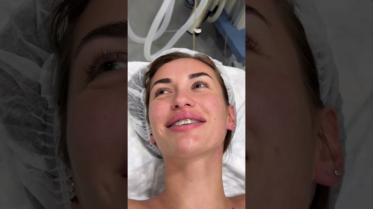 Наркоз - это не страшно! #клиникаформа