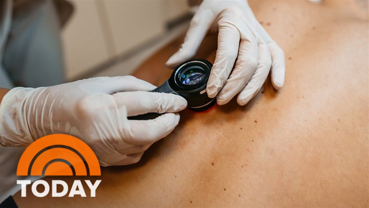 Melanoma vaccine trial appears to reduce skin cancer recurrence
