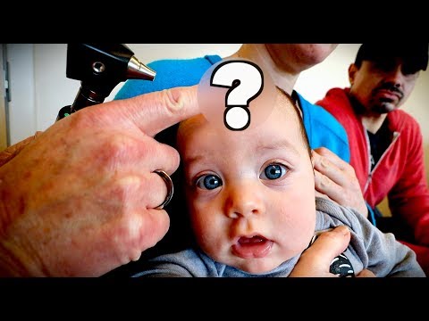 CUTE BABY with a BULGING FONTANELLE (Extremely Rare) | Dr. Paul