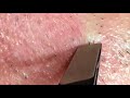 【pull out the beard】ずっと見てられる口元のヒゲ抜き 2018.5.12
