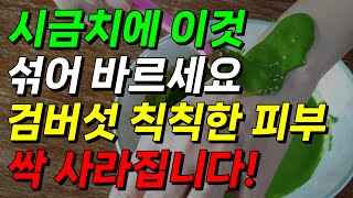 시금치에 이것 넣어 바르세요! 검버섯 칙칙한 피부 싹 사라집니다! 검버섯 없애는 방법 피부톤 밝아지는 법 칙칙한 피부 개선 시금치 천연팩