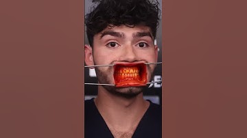 Thumbnail of Orange ASMR Snacks vs Cavities!?