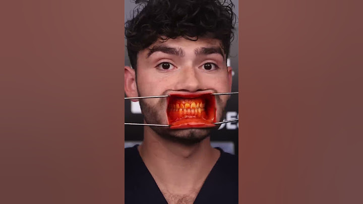 Orange ASMR Snacks vs Cavities!?