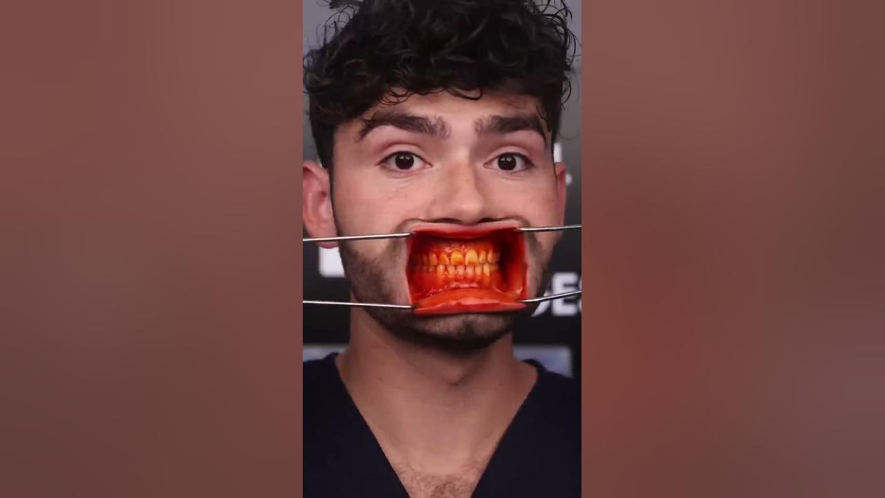 Orange ASMR Snacks vs Cavities!?