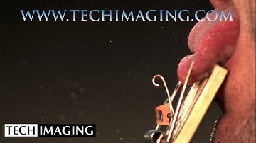 High Speed Camera Video - Mousetrap onto a tongue