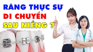 Răng có thật sự di chuyển sau niềng? Vai trò của hàm duy trì | Bác sĩ Thu Gia Lâm