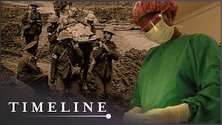 How Wars Have Transformed Medical Technology | Timeline