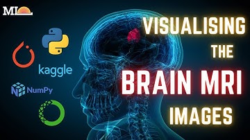 6-How to visualize our Brain MRI images?