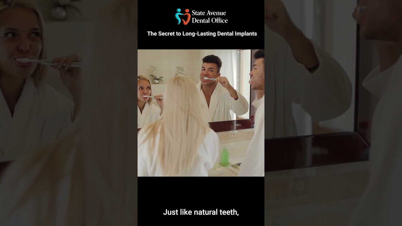 The Secret to Long Lasting Dental Implants