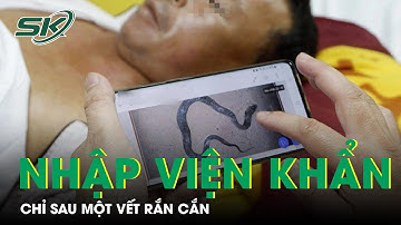 Nhập Viện Khẩn Chỉ Sau Một Vết Cắn Của Loài Rắn 