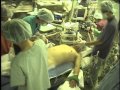 全身麻酔　心臓外科の麻酔導入  general anesthesia cardiac anesthesia
