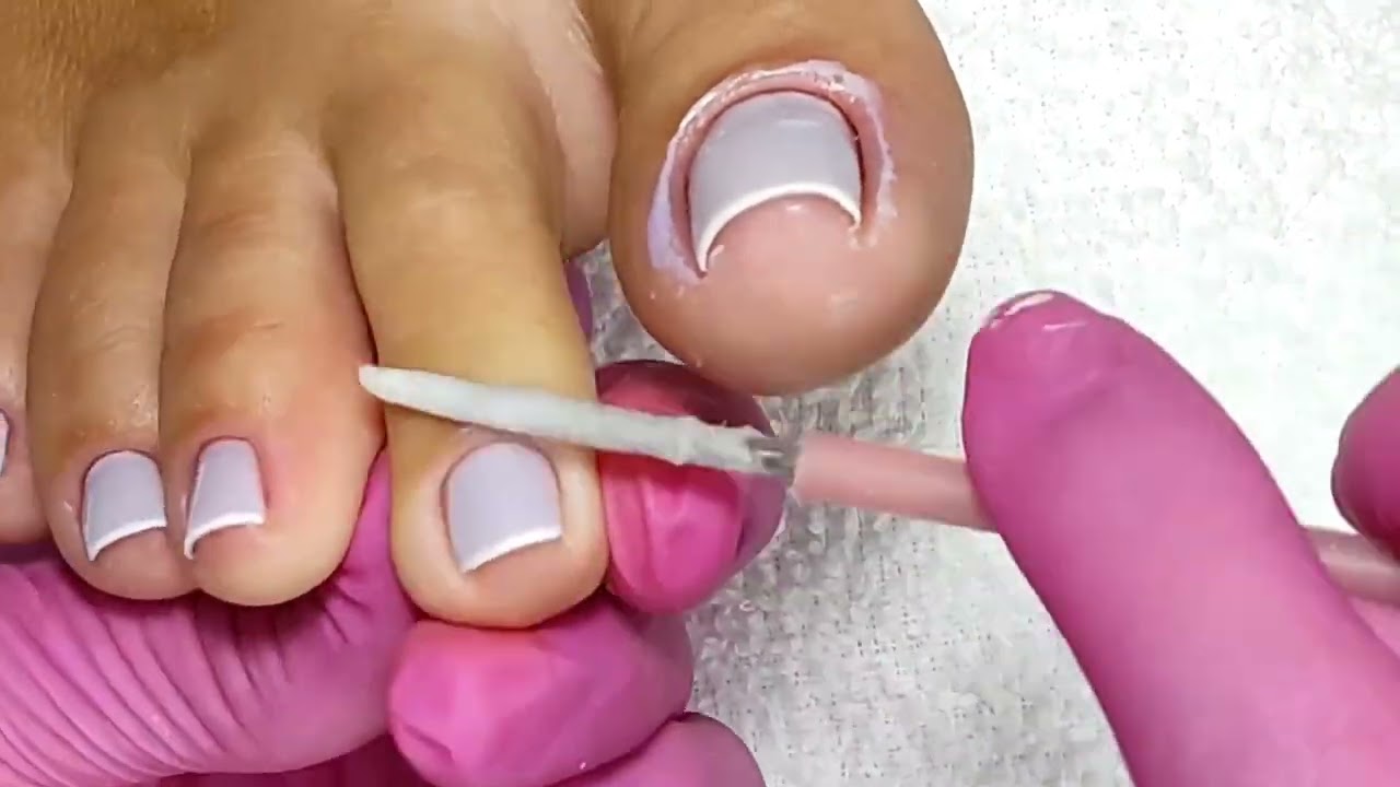 Limpeza do contorno, Acetona maravilhosa da Lutex da marca Cinco