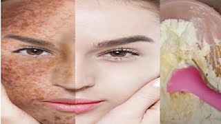 تبيض تفتيح البشرة ب اسرع وصفة طبيعية لدرجة الجنان مجربة مضمونة screenshot 5