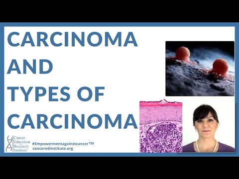 Video: Welke kankers zijn carcinomen?