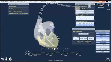Introductory Epicardio Simulation lecture - ECG, PACING, CARDIAC EP
