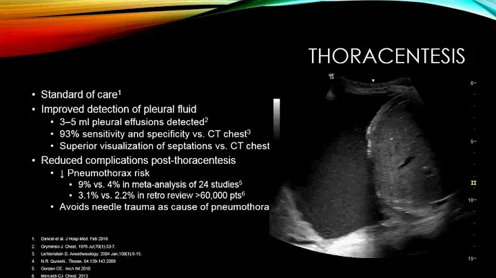 The Rise of Point of Care Ultrasound by Charles Lo...