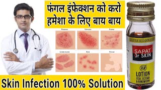 Sapat Dr Skin Lotion Review | Sapat Lotion For Fungal infection | Sapat Lotion for itch , Eczema screenshot 4