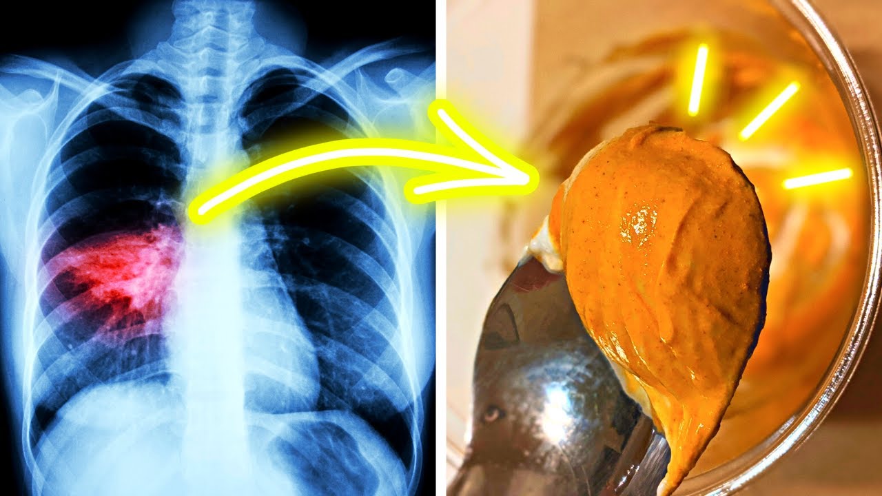 Turmeric Jelly A Miraculous Remedy To Treat Respiratory Diseases YouTube