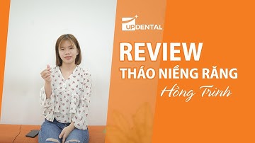 [Review niềng răng]: #139 Kết quả niềng răng của Hồng Trinh