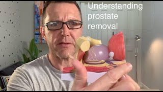 What is a robotic radical prostatectomy?