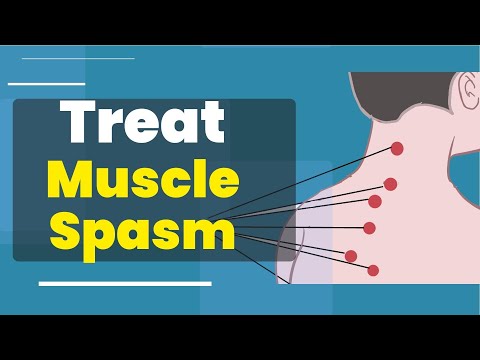 Video: 5 sätt att behandla muskelspasmer