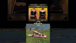 Why Your Child's Scoliosis Won't Take a Summer Break | SpineX