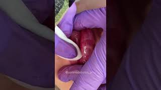 Mini clip of shading lip tattoo, #Shorts by Jasmine Diebelius 575 views 2 years ago 1 minute, 6 seconds