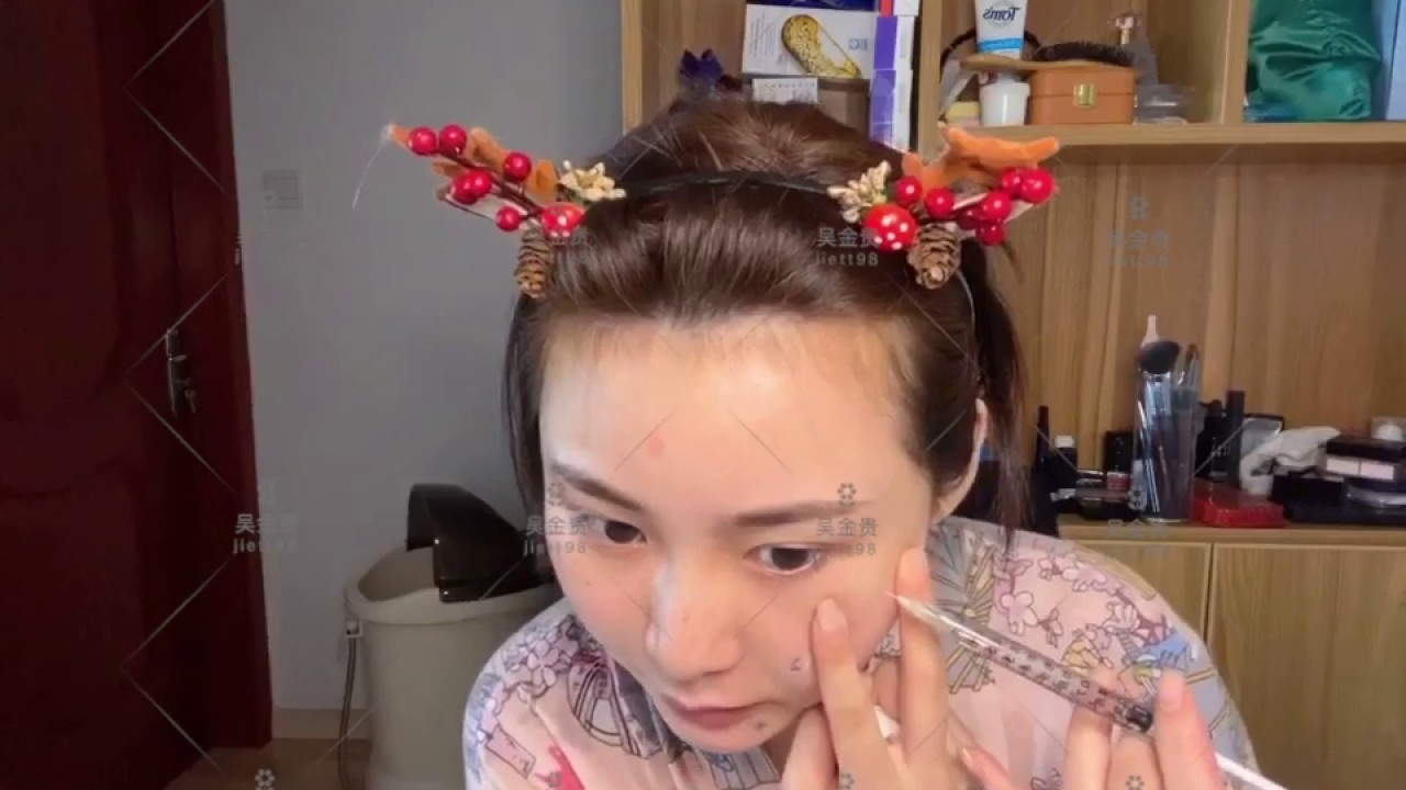 「吴金贵jiett98」瑞士profhilo五点提升逆龄针，自己注射记录