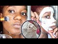 Trying A HOMEMADE Blackhead Remover Peel Off Mask | EASY DIY