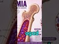 💜 LEUKEMIA 💜o🩸 ANO ANG LEUKEMIA? 🩸KILALANIN ANG LEUKEMIA 💜#viralvideo #leukemia #dialysiswarrior