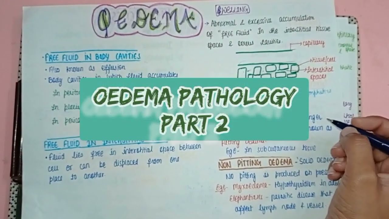 Oedema - Types, Causes, Symptoms & Treatment - Part 2 || Pathology