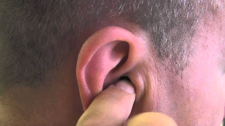 The visual difference between a CIC hearing aid + ...