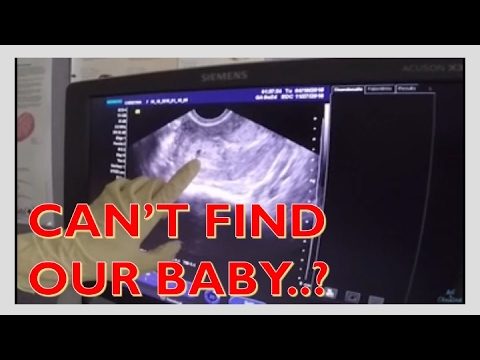 Heartbeat pregnant no Your question: