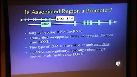 Exfoliation Glaucoma: Time for a Cure?