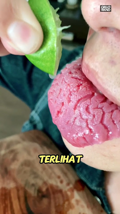 Causes of a Chapped Tongue‼️😱