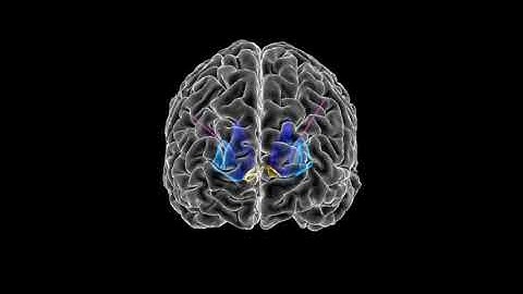 2021 First Place Video Winner: DBS Lead Placement for OCD