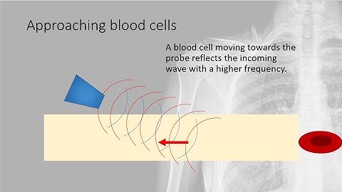 A Level Physics | Medical physics | 6.  The Doppler Effect