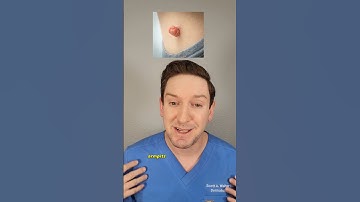 Dermatologist explains SKIN TAGS: What are they? Do they need to be removed? #skintags #derm