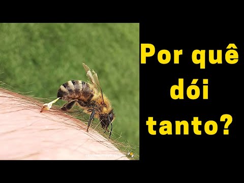 Vídeo: A picada de abelha dói?