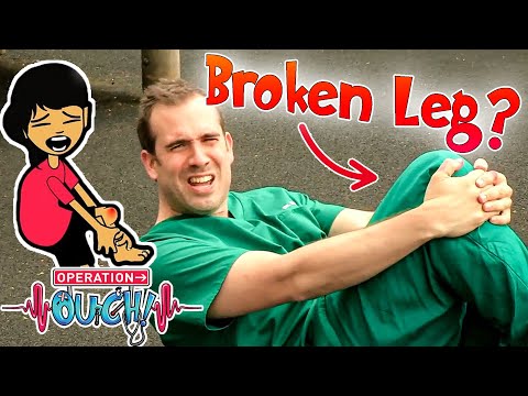 Broken Leg First