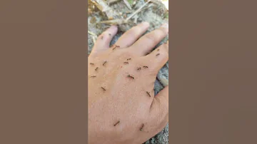 Что делать если напали муравьи Укус муравья What to do if ants attack Ant sting