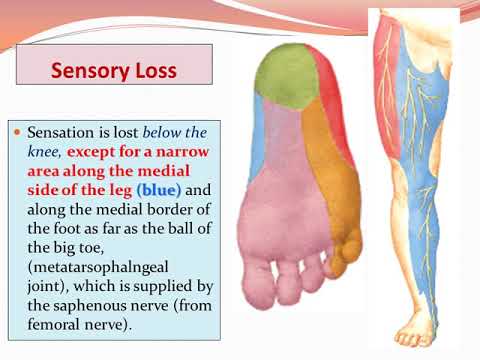 Nerves Of Lower Limb part 2 - YouTube