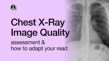How to Assess CXR Image Quality & Adapt Your Read