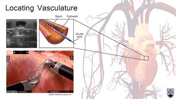Automatic Vessel Segmentation from Pulsatile Radial Distension