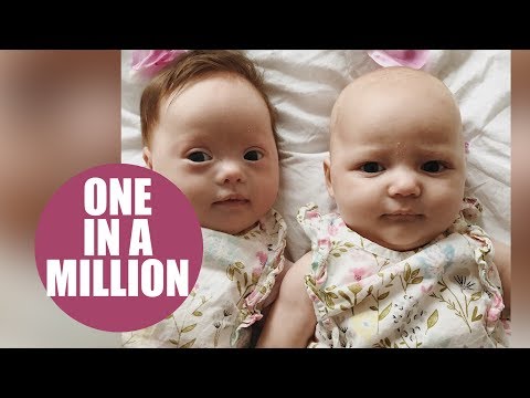 Meet the 'one in a million' twins - one with Down's syndrome and the other without