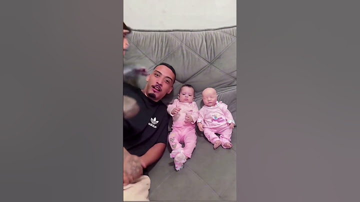 MACACO DEIXOU BEBÊ FOFO CARRCA 😂❤️😱MONKEY LEFT CUTE BABY BALD❤️🥰😱#shorts