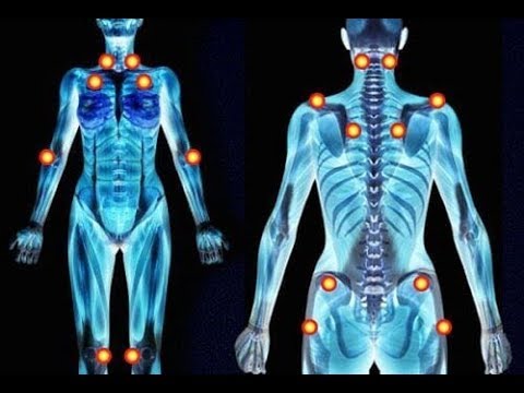 Vijf vroege tekenen van fibromyalgie