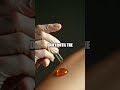 Honey Footnotes Wound Healing for Every Age